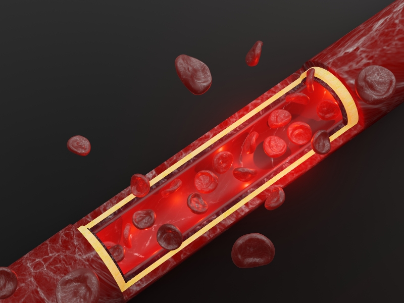 Mối Liên Hệ Omega-3 Và Huyết Áp