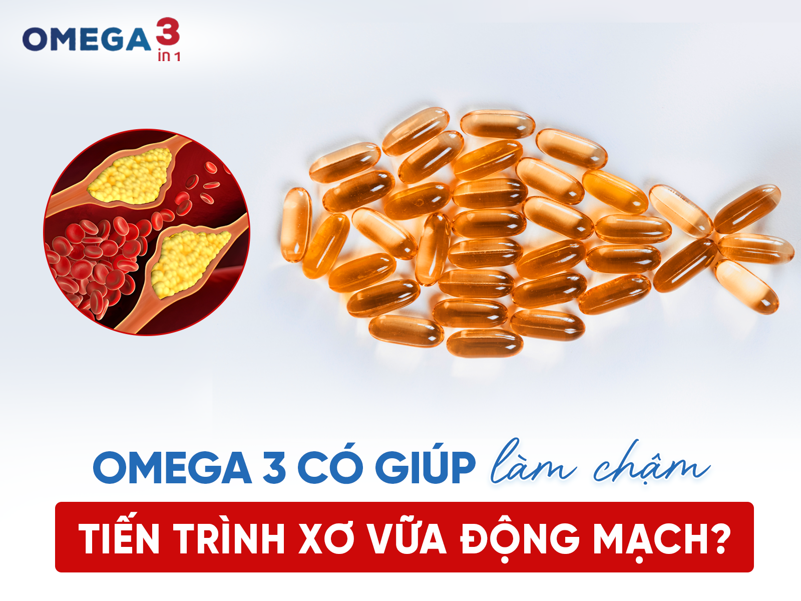 Omega-3 Có Giúp Làm Chậm Tiến Trình Xơ Vữa Động Mạch?